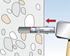 Image sur Ancorante con corpo espandente SLM con barra